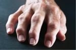 What You Need To Know About Arthritis