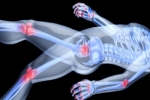 What You Need to Know About Joint Pain