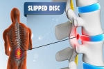 What You Need To Know About Slipped Disc