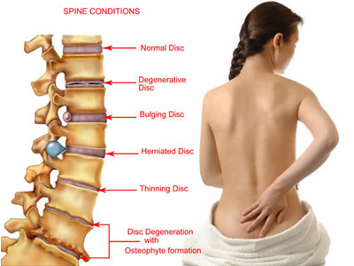 Blog  Myths about Causes of Back Pain/Problems