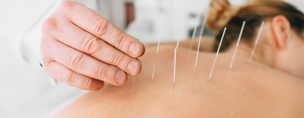 Blog | CMS Looking at Acupuncture for Back Pain