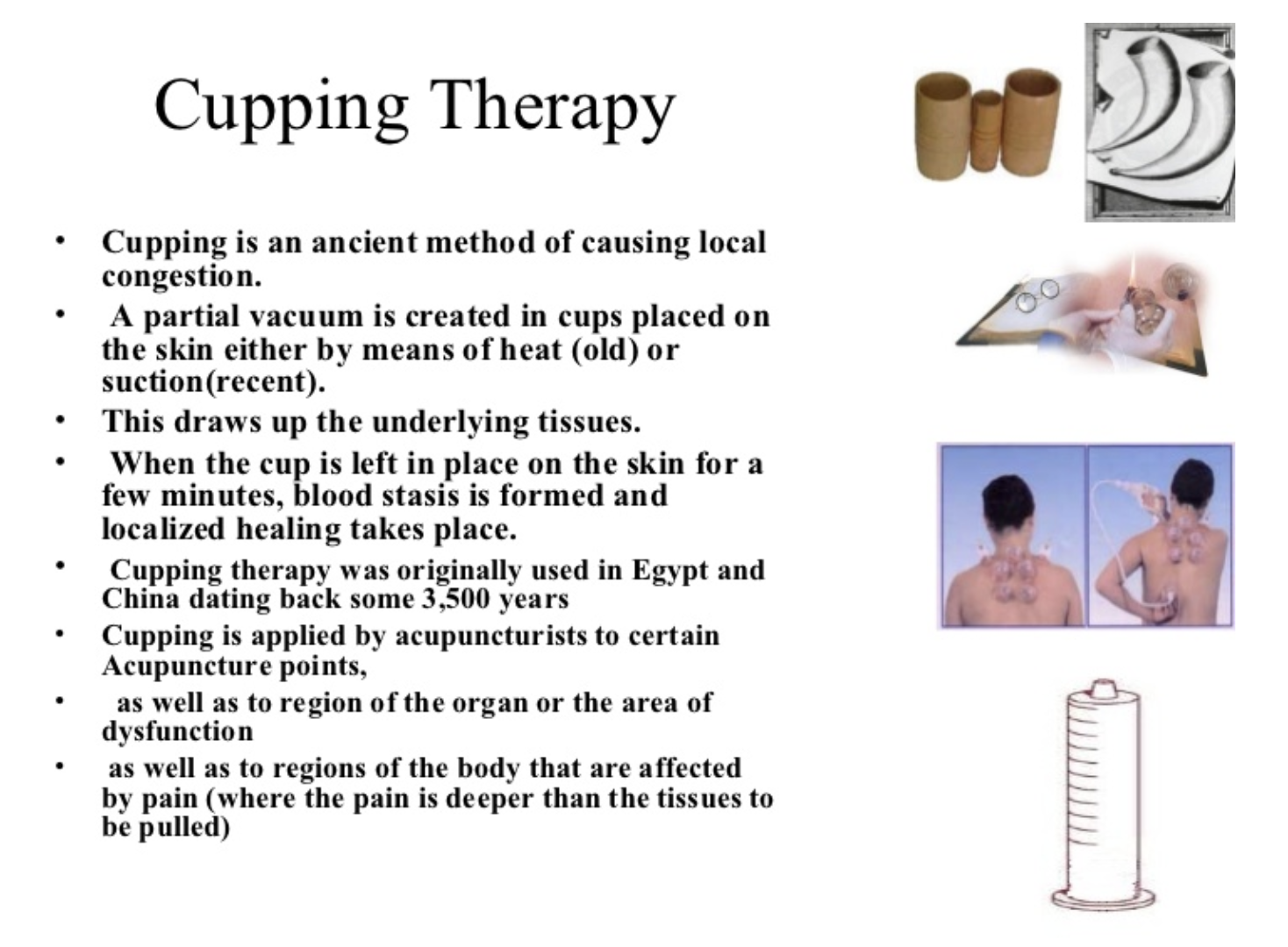 Blog Relieve Stress With Cupping Therapy