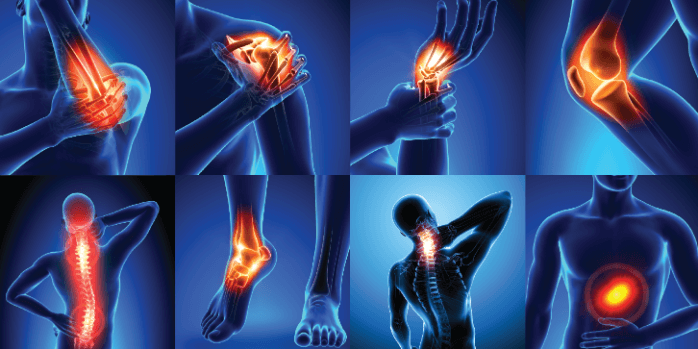 Blog | What You Need to Know About Joint Pain