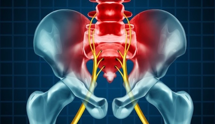 Coccyx WEDGE CUSHIONS are usually better than doughnut cushions for Tailbone  Pain, Coccyx Pain, Coccydynia.